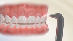 Vo Dentistry